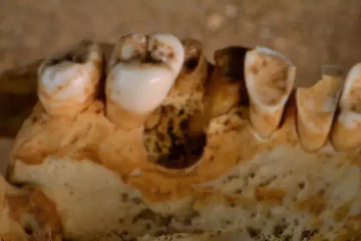 他们口含尿液治牙病，还为一口好牙不惜盗尸掘墓、奔赴战场