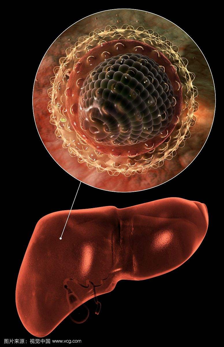 中医抗乙肝病毒的中药方剂,抗乙肝病毒中药有哪些