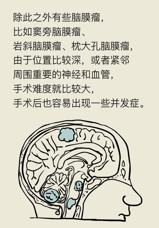 脑袋里长瘤子一定要切除吗,脑袋里长瘤能治好吗
