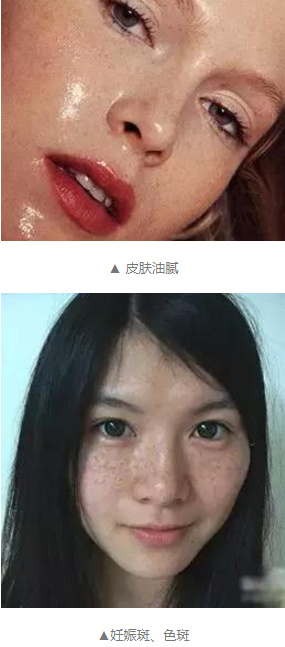 孕妇皮肤变差如何护肤,怀孕期多护肤皮肤是不是会变好