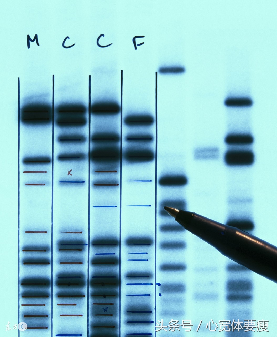 12周阴性排除艾滋病概率,艾滋病检查阴性是什么意思