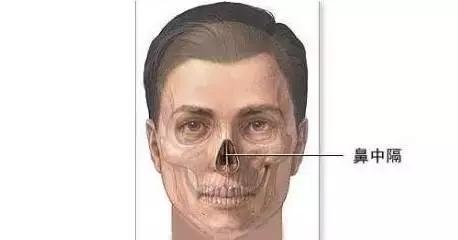 假体隆鼻都有什么术式,假体隆鼻一般用什么材料