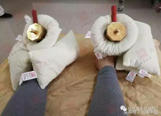 艾灸后可能出现的妇科排毒反应,艾灸膻中穴排病反应及处理方法