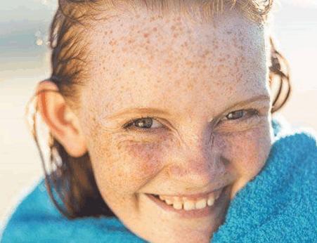 你脸上的斑是怎么出现的?不同部位长斑的原因