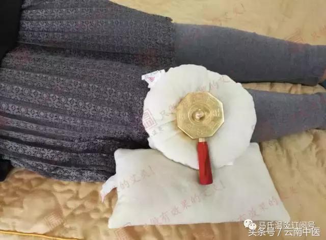 艾灸后可能出现的妇科排毒反应,艾灸膻中穴排病反应及处理方法