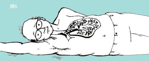 请你跟我这样做,当你发现咳血或者呕血的人