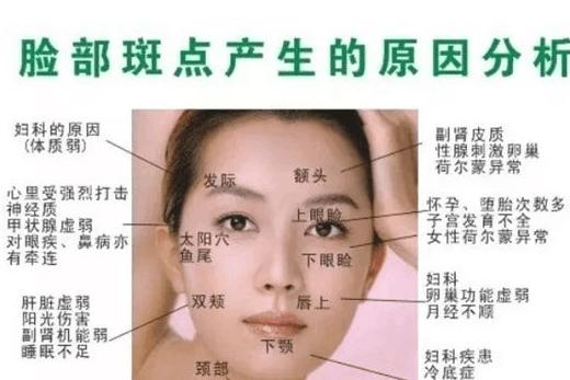 你脸上的斑是怎么出现的?不同部位长斑的原因