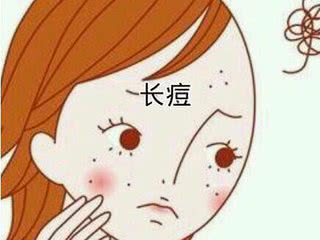 长痘的人到底有多惨如何正确祛痘,祛痘痘最好最实际的方法