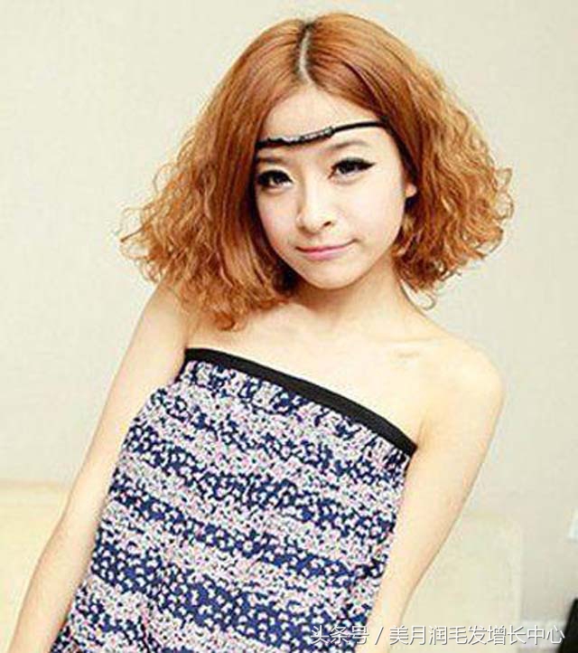 如何改变头发细软的问题,有什么办法解决头发稀疏