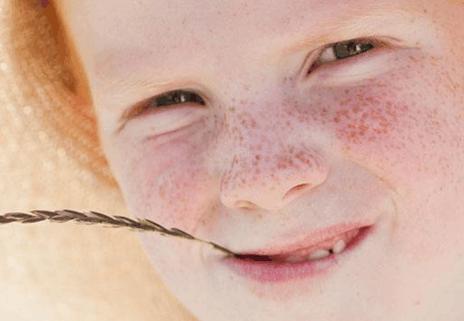 你脸上的斑是怎么出现的?不同部位长斑的原因