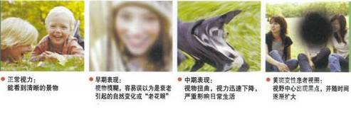 黄斑病变的克星,得了黄斑病变需要忌什么食物