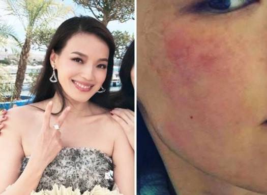 秋天嘴皮干燥起皮什么原因,秋天皮肤干燥起皮用什么护肤品