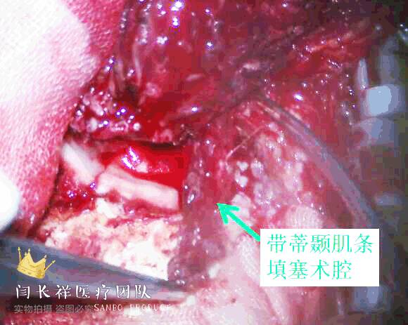 烦人的耳鸣,烦人耳鸣