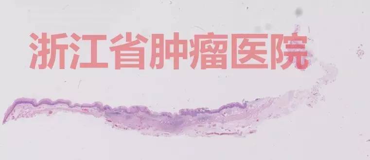 食管大面积黏膜病变,看看这家医院如何处理?!