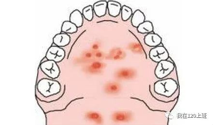 儿童常见传染病防治知识,儿童常见传染病防治ppt课件