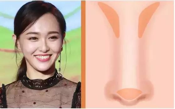 整容级丰唇画法,整容鼻子有哪几种鼻型图解