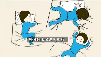 手麻手僵硬是哪种颈椎病导致的,手麻是颈椎病造成应看什么科