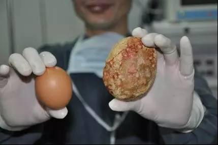 少儿常见亚健康症状有哪些,健康疾病怎么预防