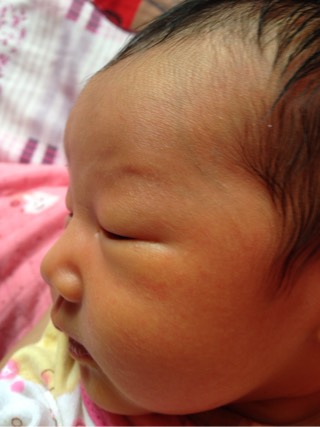 新生儿黄疸的那些事儿要知道,宝妈应该知道的新生儿黄疸小知识