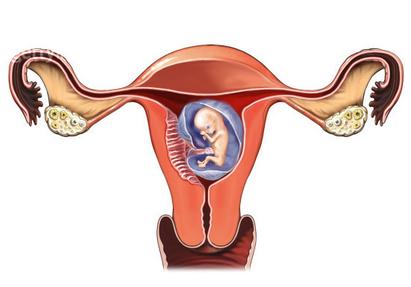 宫内孕不等于宫外孕？一字相差害人命！