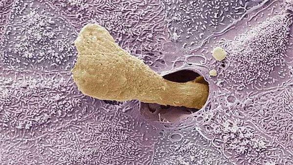 一不留神竟让孩子鼓膜穿孔！孩子身上这个地方可不是你想碰就能碰