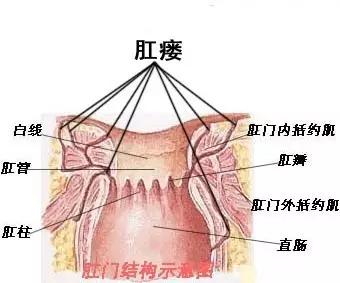 肛瘘中医诊断及鉴别,肛瘘如何诊断