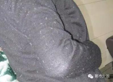 口红沾衣服上了怎么解决,白衣服染上口红快速清洗的小妙招