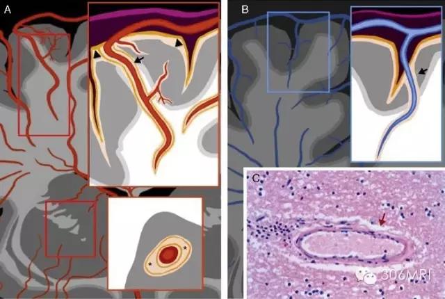 核磁共振轻度脑白质征象,脑白质内见多发斑点什么状况