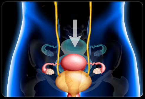 盆腔疼痛怎么引起的,盆腔疼痛是什么原因引起的