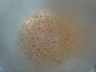 简单教你读懂尿常规|香港大学深圳医院肾内科