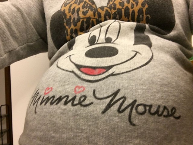 做了宫颈环,保胎宫颈环扎拆线最佳时间