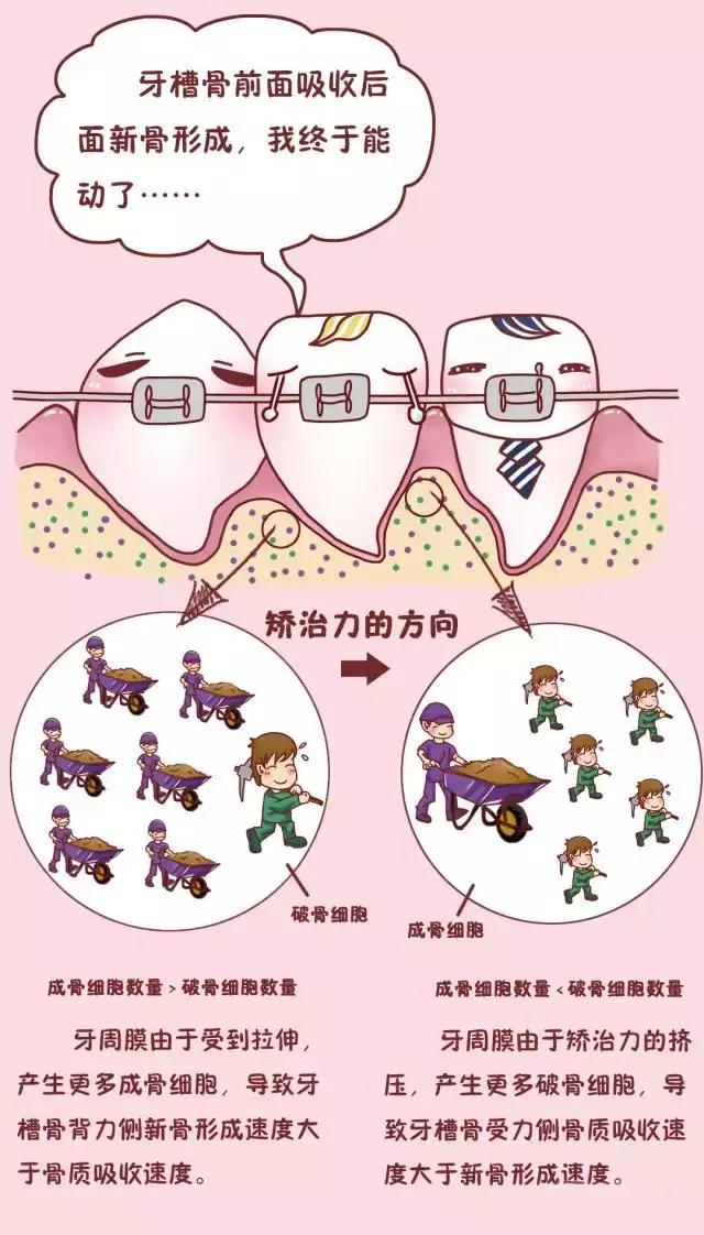 隐形牙套矫正过程中牙齿松动,矫正牙齿导致牙齿脱落是什么原因