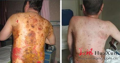 济南老人跳楼事件,济南老人跳楼事件新闻最新