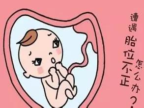 24周胎位不正需要担心吗,胎位不正的原因及纠正方法图片