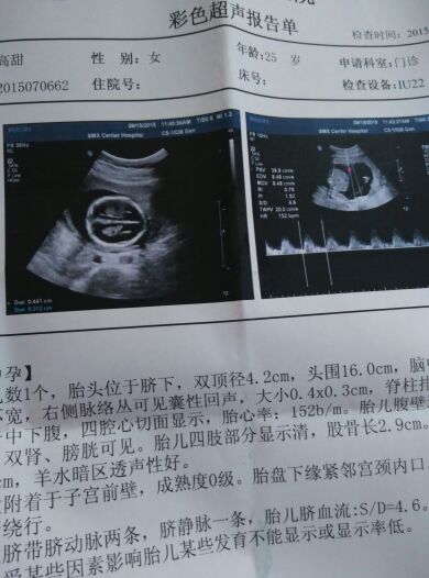 宝妈分享怀宝宝的症状,怀了女宝初期感受