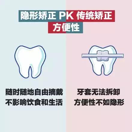 美丽刻隐形矫正怎么样,隐形矫正牙齿视频教程