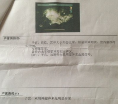 备孕六个月就成功了,备孕五个月成功好孕