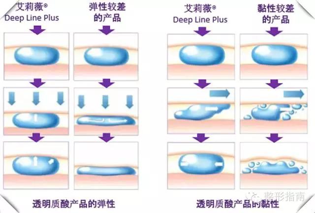 500元的玻尿酸是什么品牌,玻尿酸品牌中国市场占有率