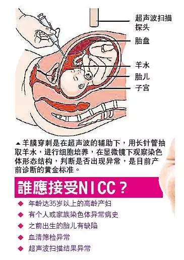羊膜穿刺肚子特别疼怎么办,打了羊膜穿刺肚子微痛