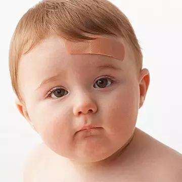 宝宝额头反复磕出大包消不掉,额头磕了个大包怎么快速消肿