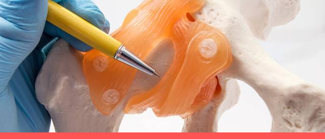 长期吃激素药怎样预防股骨头坏死,股骨颈骨折后怎样预防股骨头坏死