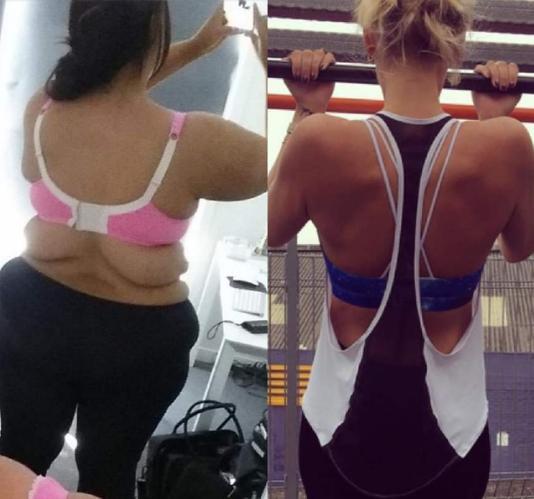 减肥后皮肤松驰多久才能恢复,减肥后皮肤松驰