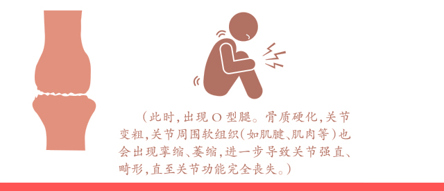 老年骨关节炎最佳治疗方法,老年骨关节炎最好的治疗方法