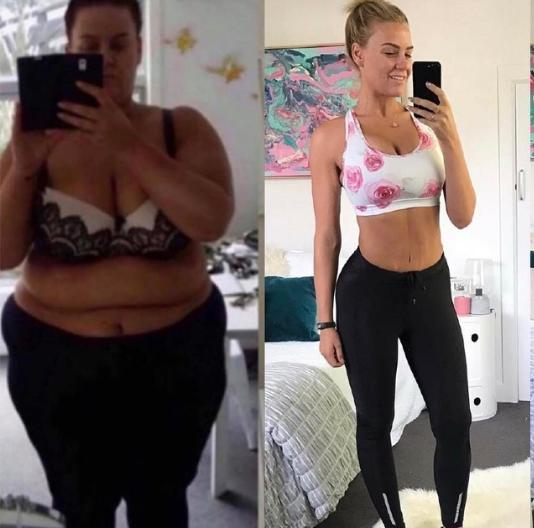 减肥后皮肤松驰多久才能恢复,减肥后皮肤松驰