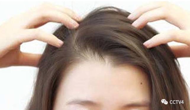 秋天一到就很会掉头发,如何解决头发枯黄脱发问题