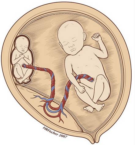 产前疾病筛查是查什么病,产前筛查介绍