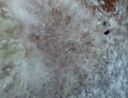 中药中的苍术,中药苍术配方大全