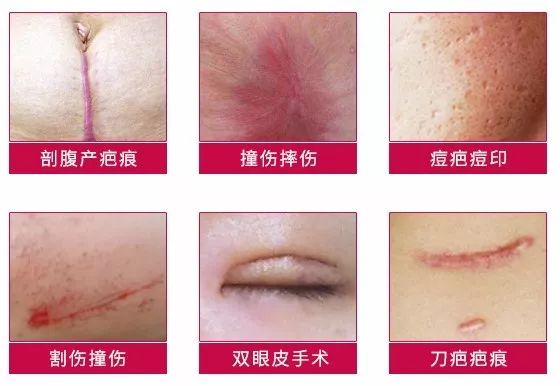 理肤泉和雅漾更适合屏障修复,药妆护肤品好还是普通的护肤品好