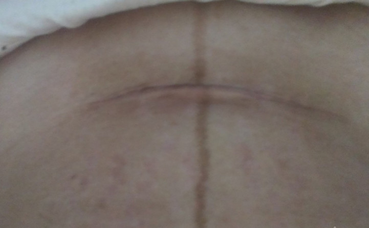 5个月孕妇含泪做引产,医生提醒女性不要像她一样鲁莽!