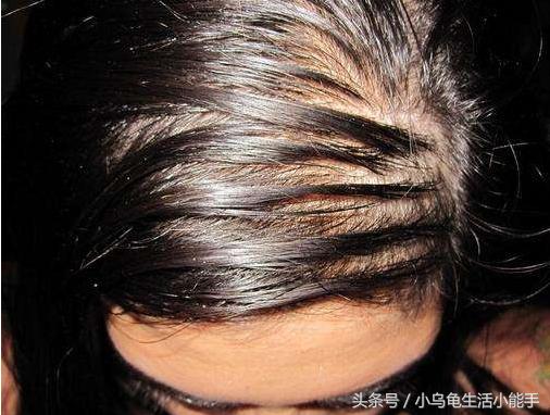 头发如何打理才能不出油,刚洗完头发就感觉油油的咋回事